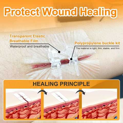 Image of [ST202] 2PCS Advanced Wound Closure Kit: Zip Stitch Laceration & Dressing Set