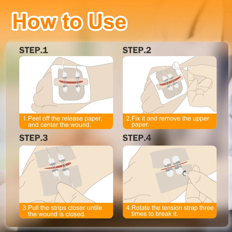 Image of [ST202] 2PCS Advanced Wound Closure Kit: Zip Stitch Laceration & Dressing Set